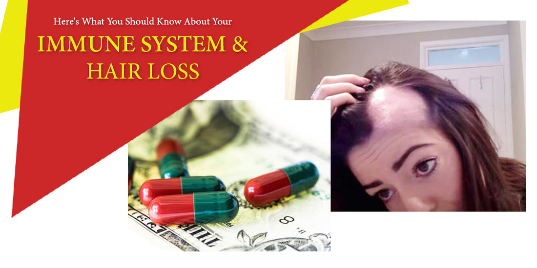 HERE’S WHAT YOU SHOULD KNOW ABOUT YOUR IMMUNE SYSTEM & HAIR LOSS